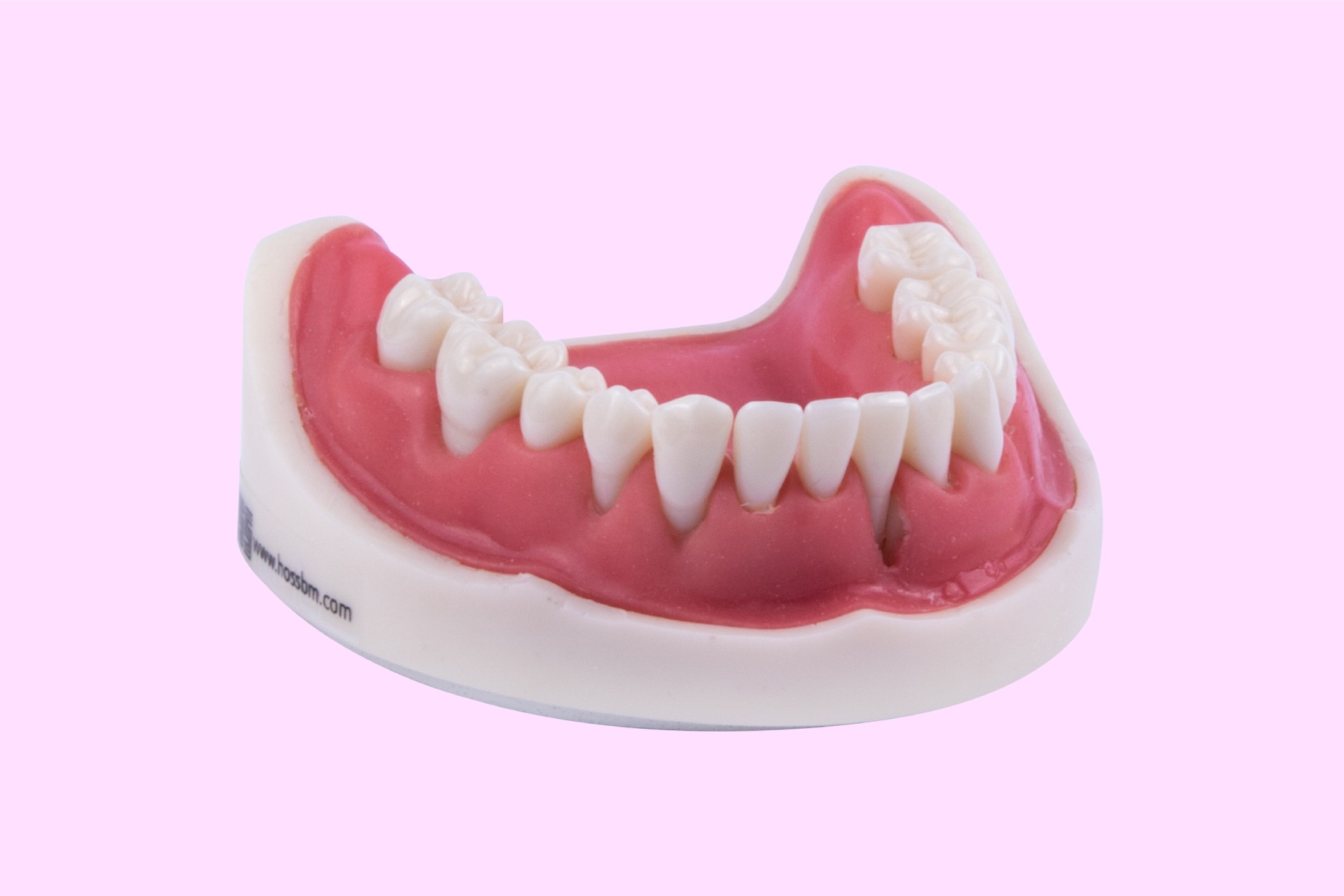 Gingival Atrophy Model Lower Jaw