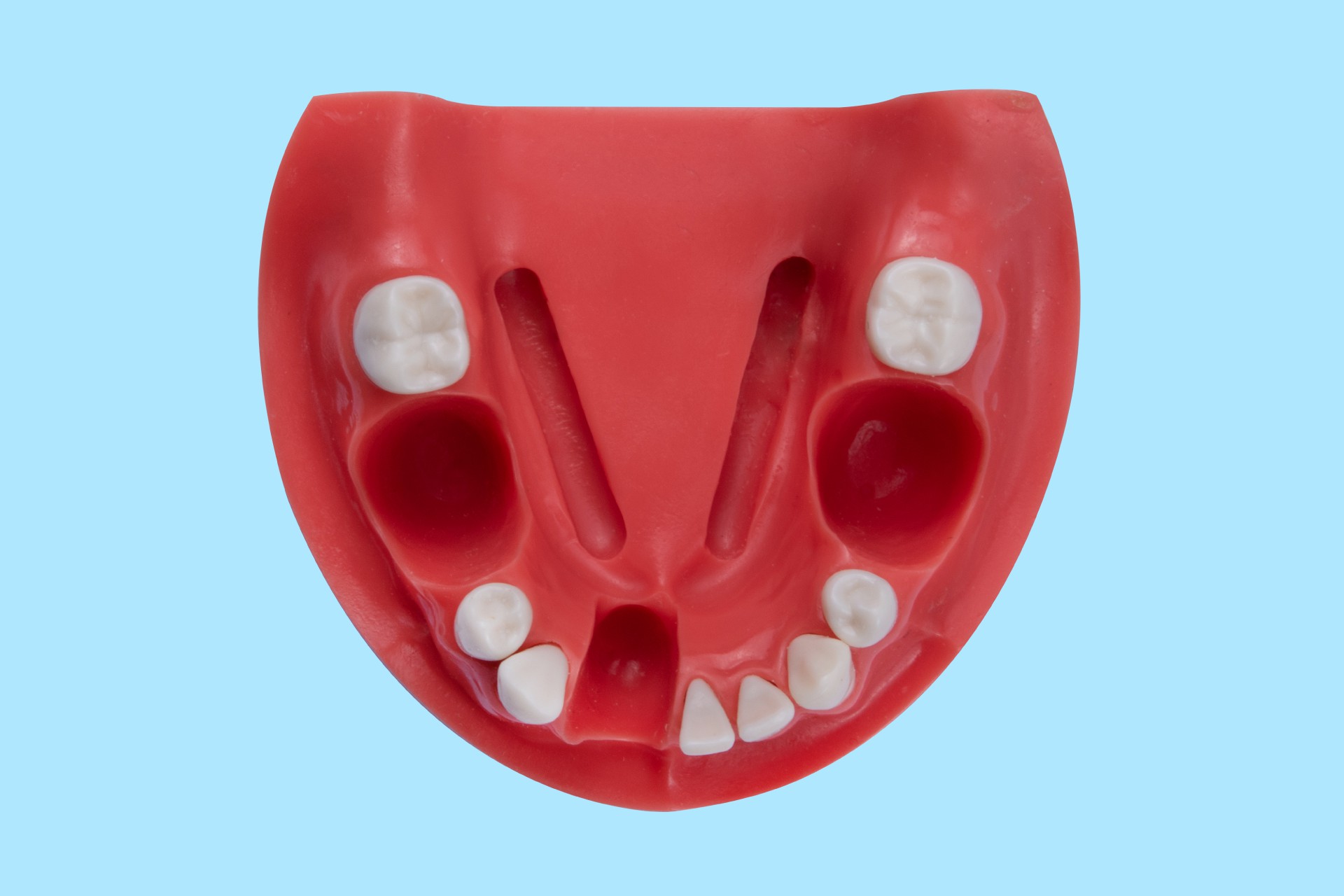 مدل فک جهت عکس برداری از دندان