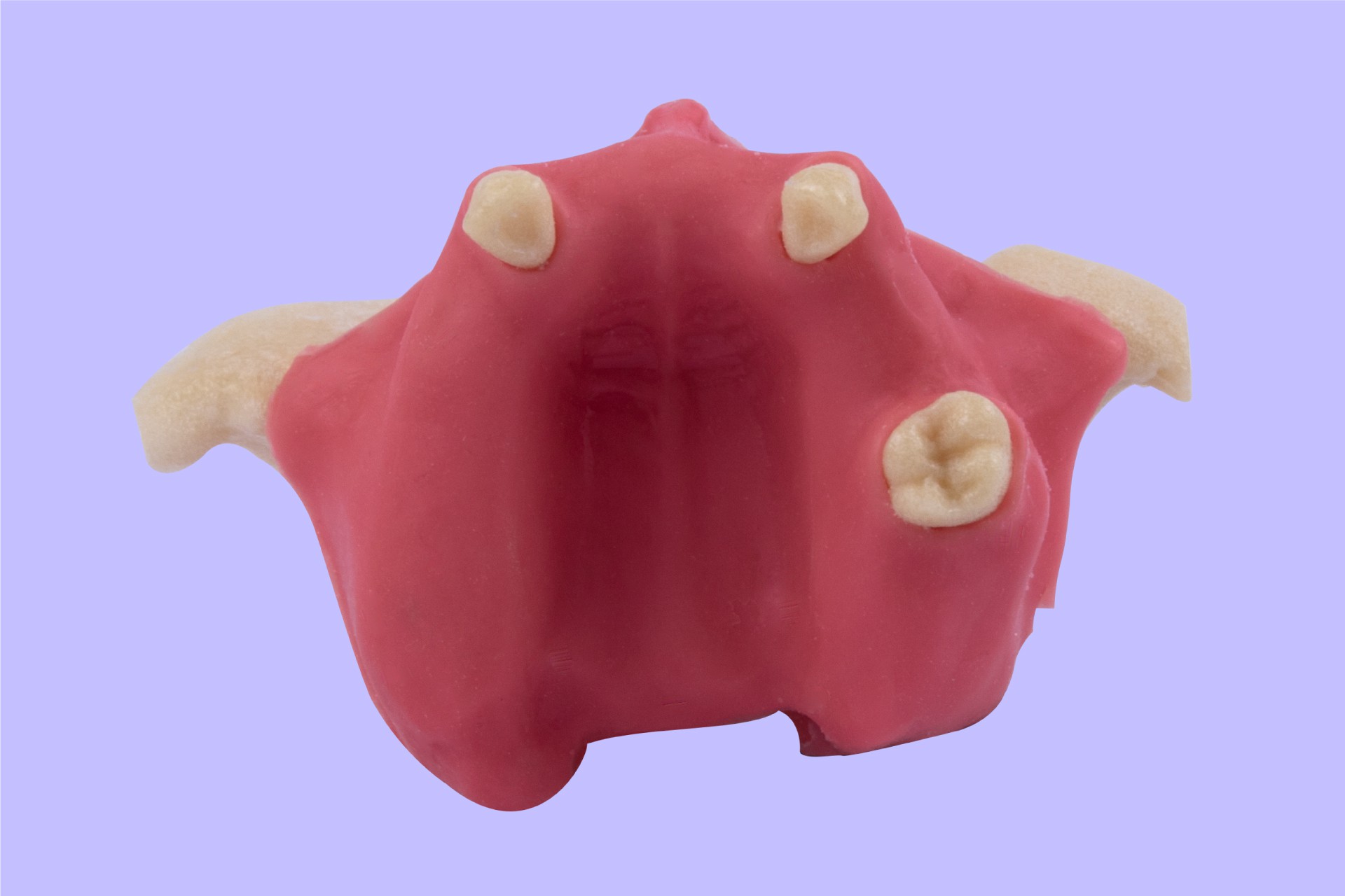 فک بالا بی دندانی به همراه سینوس و خروجی های عصب همراه لثه نرم و پریوست