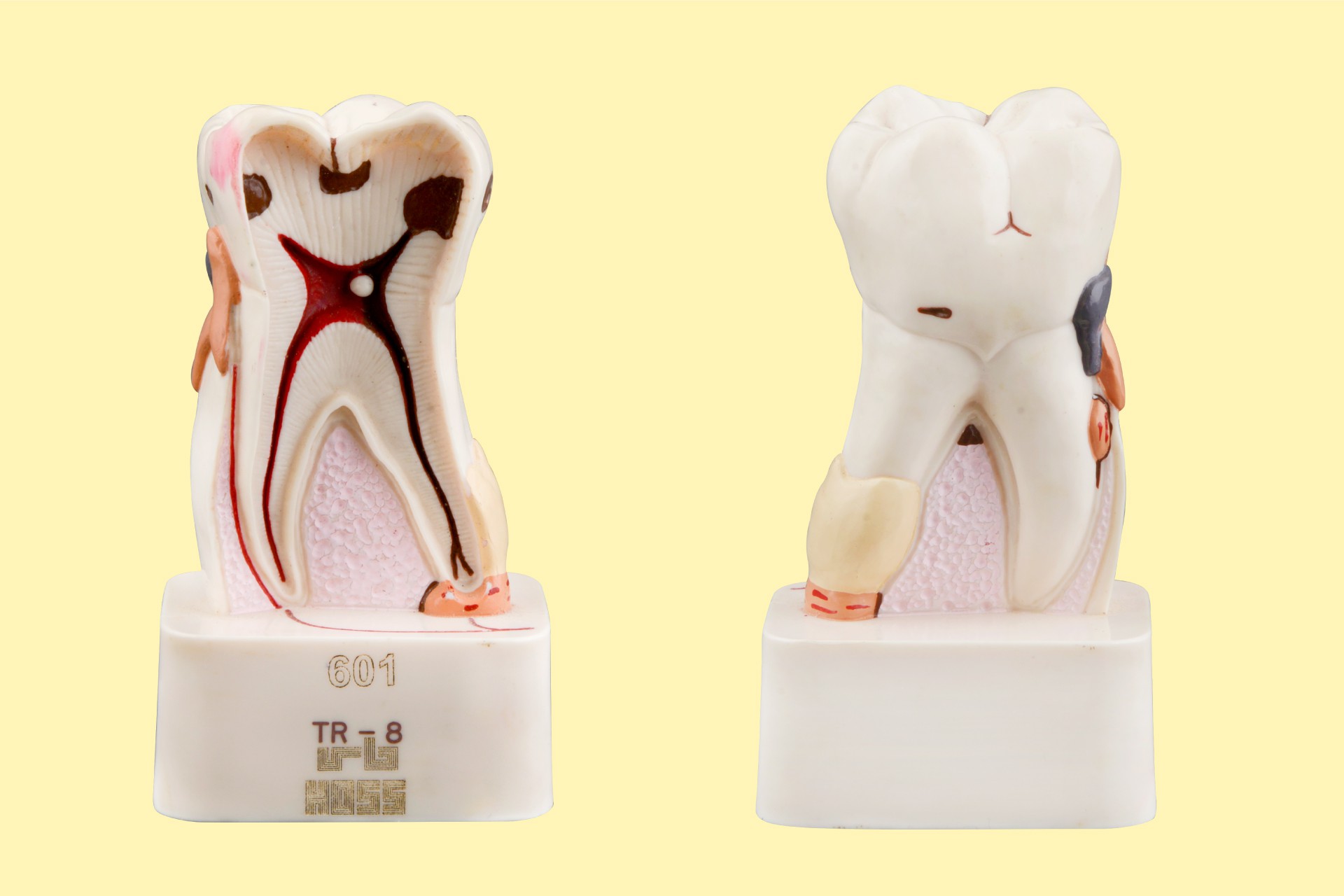 مدل نمایشی پاتولوژی دندان